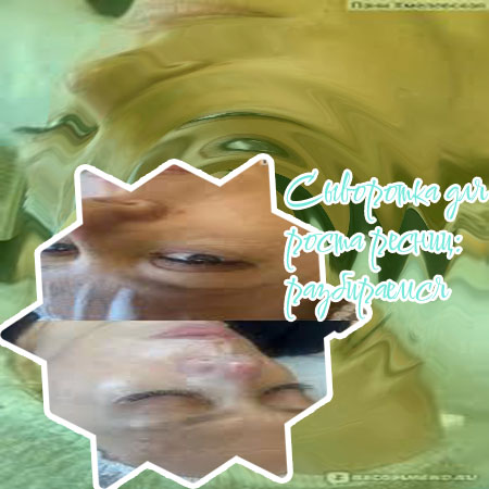 Сыворотка для роста ресниц до после